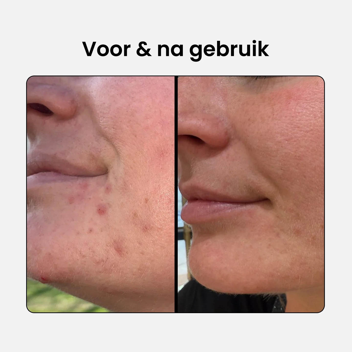 Productafbeelding 4