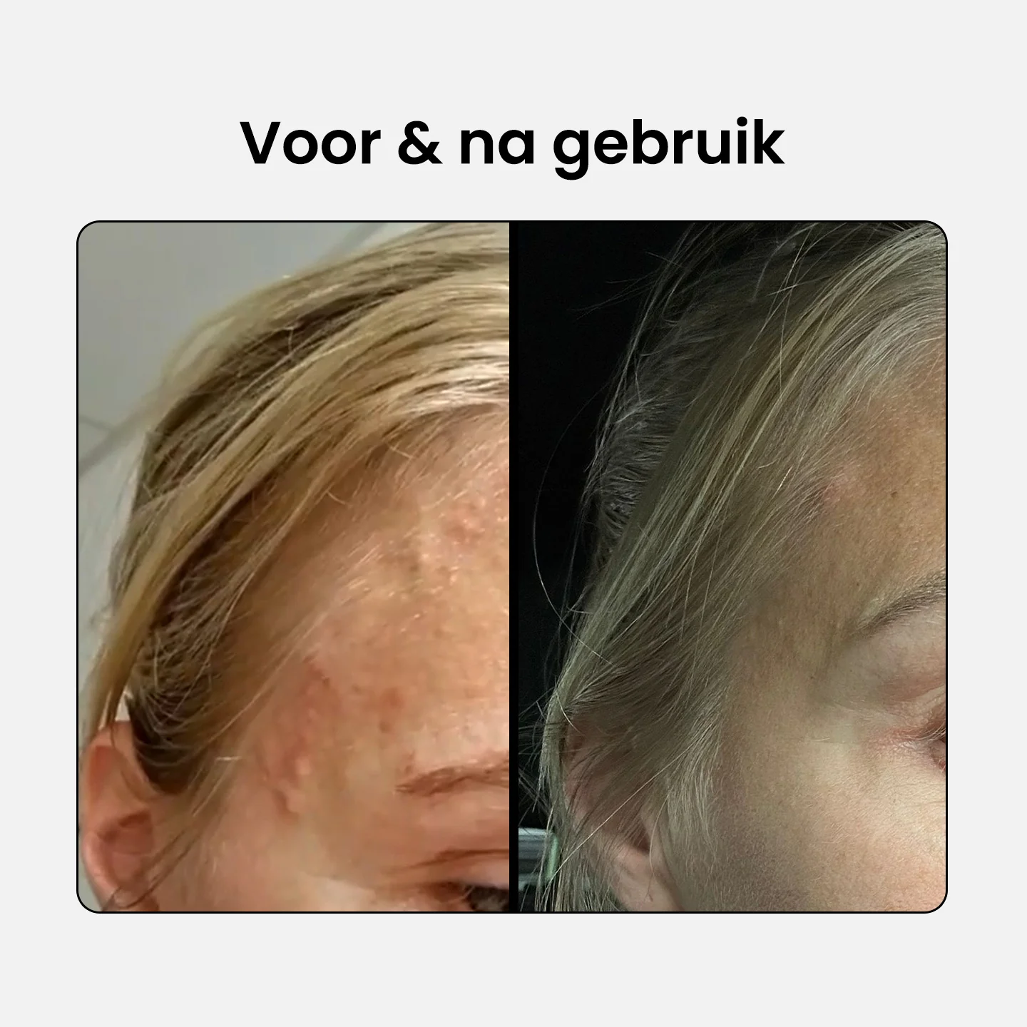 Productafbeelding 6