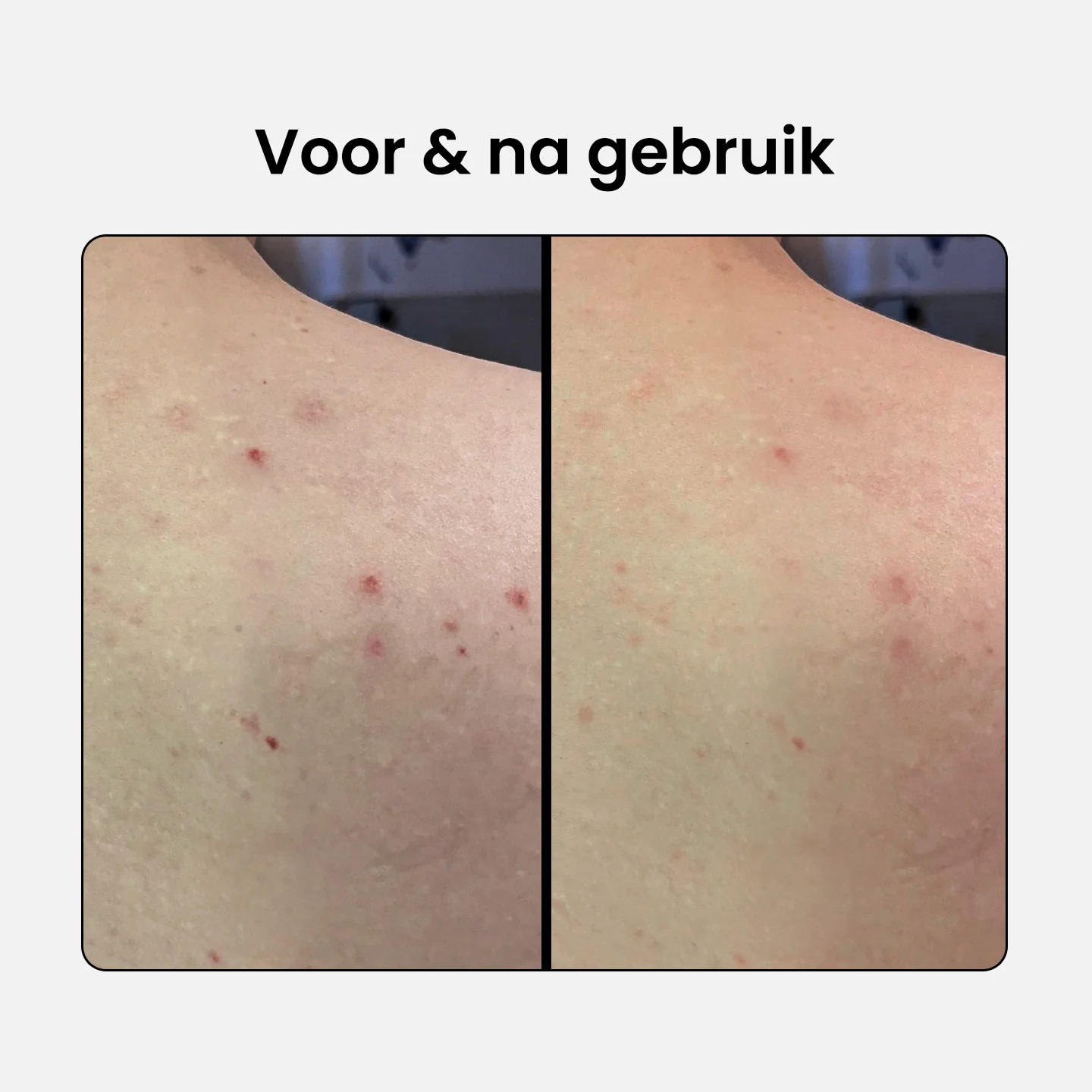 Productafbeelding 5